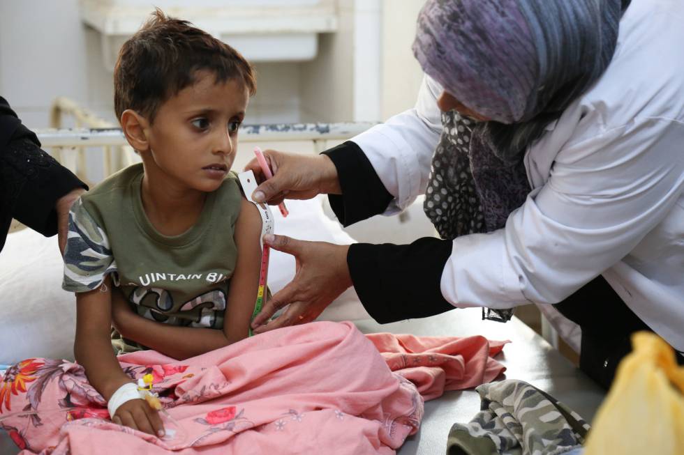 Una enfermera le mide el brazo a un niño con cólera en el hospital de Aden, en Yemen.