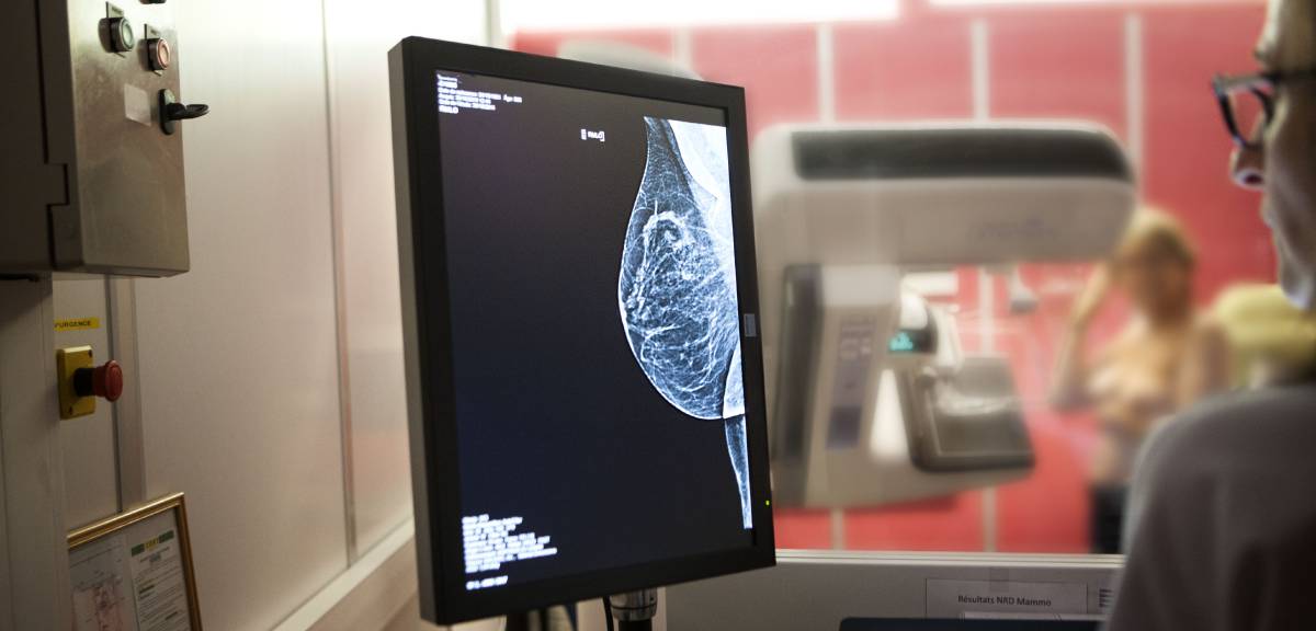 Mammography screening.