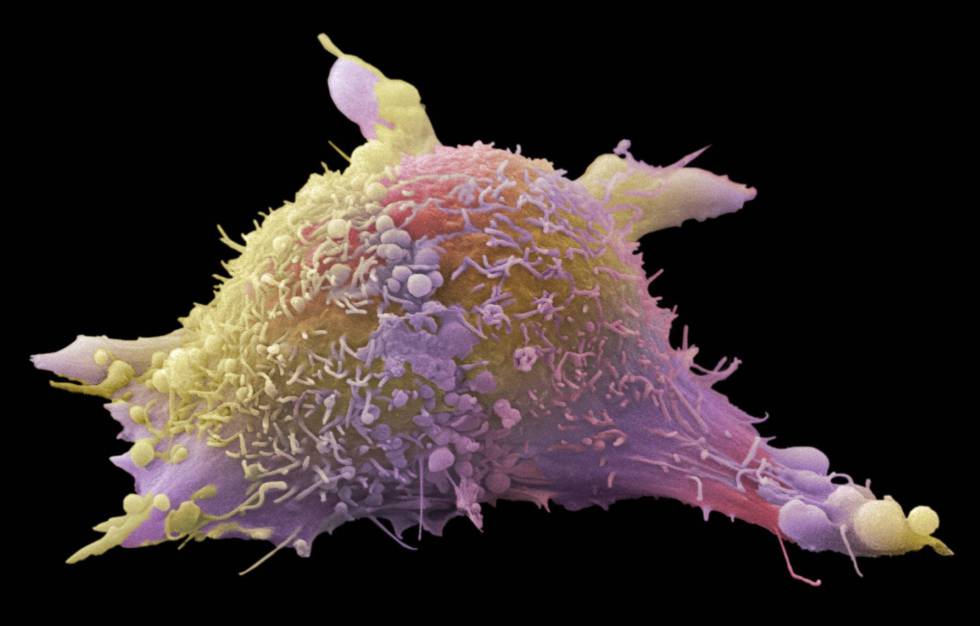 Inmunoterapia contra el cáncer: un nuevo paradigma