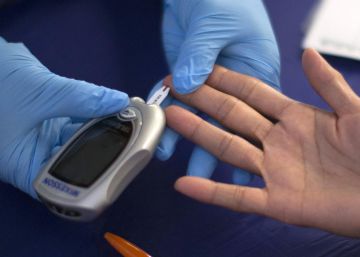 Six surprising ways diabetes may affect your skin