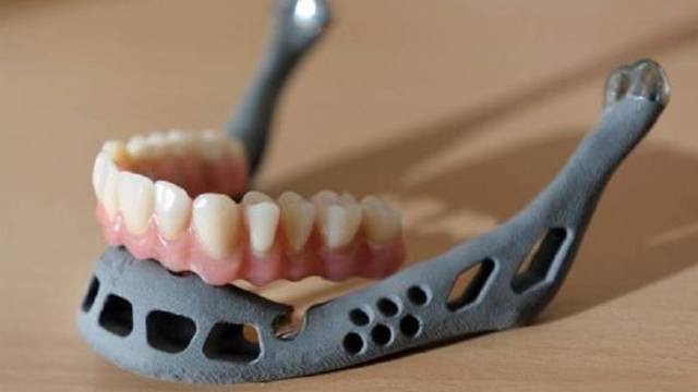 La parte inferior de la mandíbula, hecha de titanio.