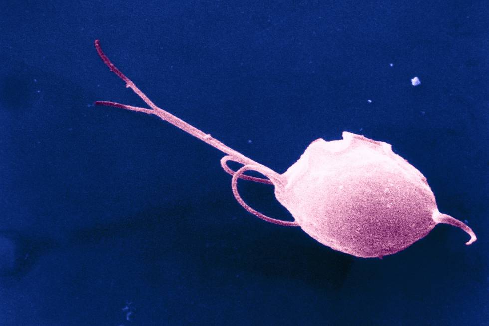 cuales son los primeros sintomas de la tricomoniasis