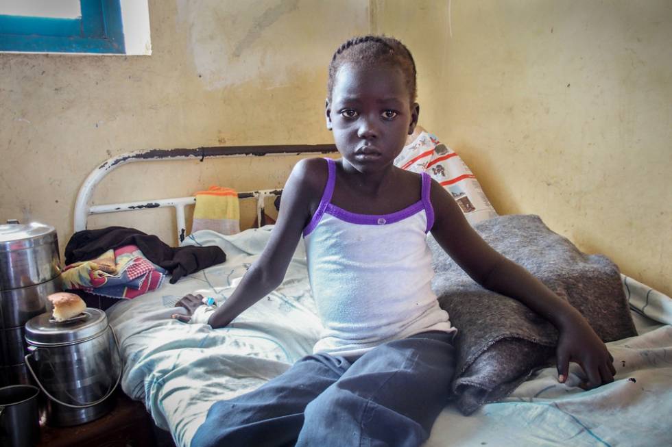 Nyajinma, 6, foi mordida por uma cobra enquanto dormia no do Sudão do Sul.