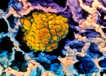 La mitad de los cánceres ya se curan. ¿Nos ponemos con la otra mitad?