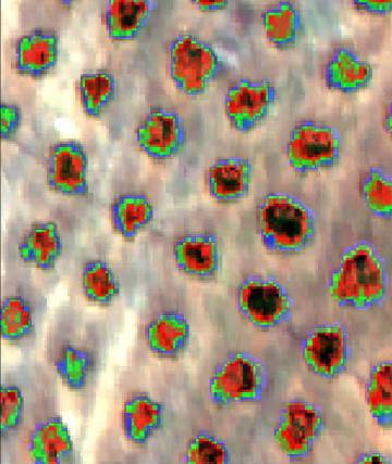 Esta imagen compuesta tomada por una cámara hiperespectral muestra las copas de los árboles. En verde, las zonas enfermas por la bacteria.
