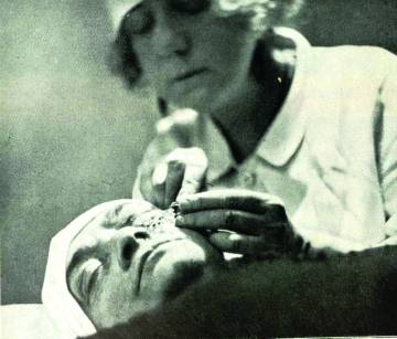 La cirujana, en una operación para corregir las ojeras.