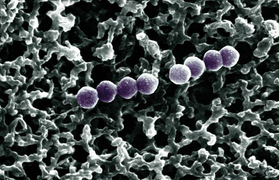 Las bacterias de la especie 'Streptococcus pneumoniae' pueden provocar neumonÃ­as letales.