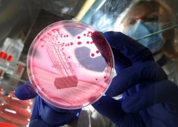 Los secretos del microbioma humano