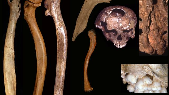 Los humanos ya cuidaban a sus discapacitados hace 200.000 años