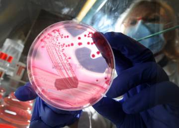 Los secretos del microbioma humano