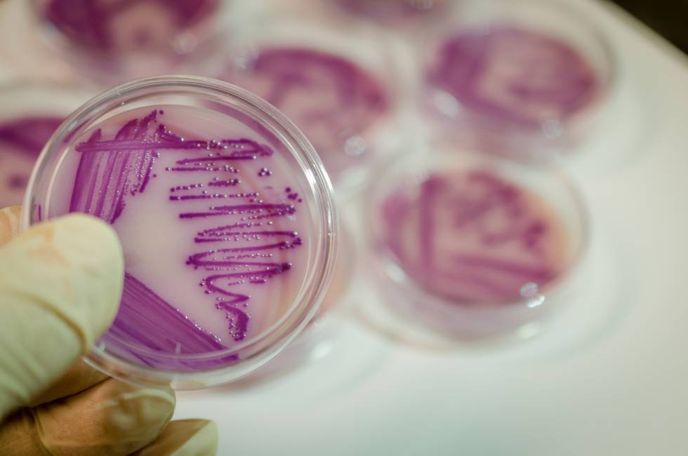 La 'Escherichia coli' (imagen de un cultivo) es una de las bacterias que mÃ¡s resistencia a antibiÃ³ticos ha desarrollado.