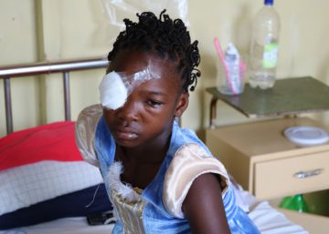 La equidad de género en la salud ocular: un reto alcanzable