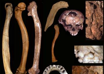 Los humanos ya cuidaban a sus discapacitados hace 200.000 años