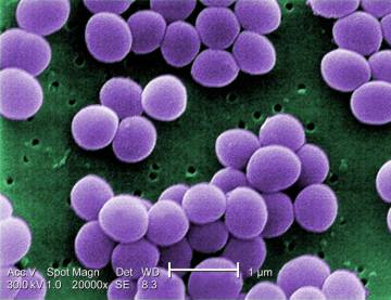 ‘Staphylococcus aureus’, una de las bacterias más comunes de nuestra piel. 