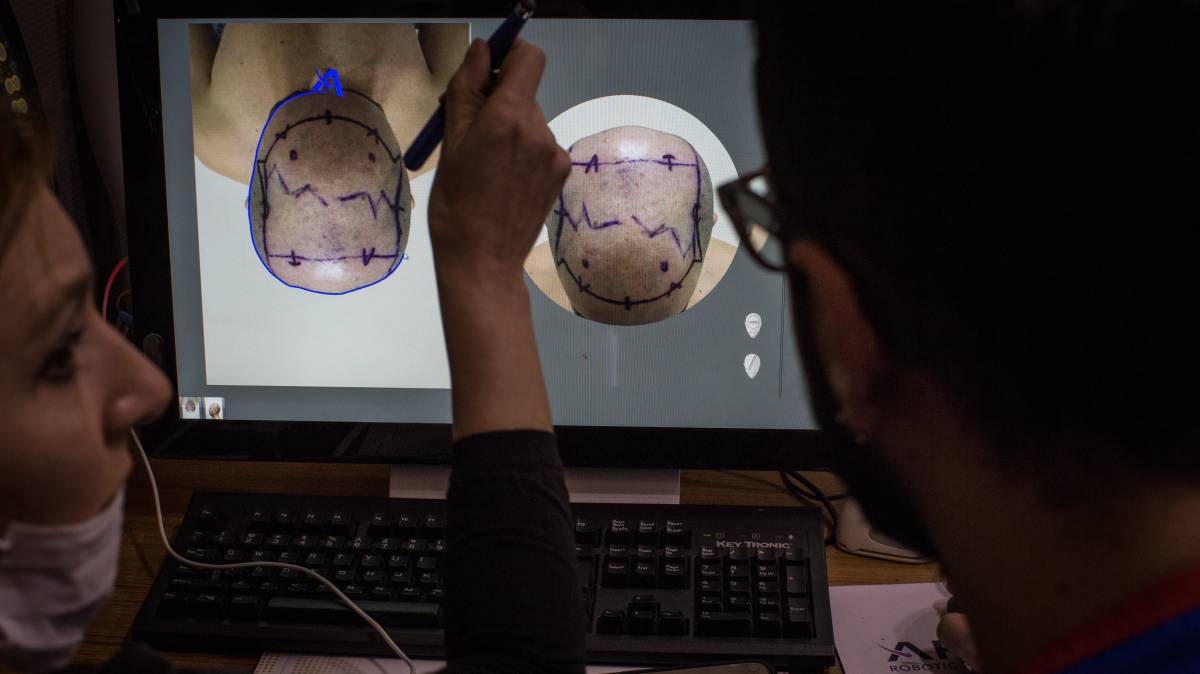 Doctores evalúan a un paciente en Turquía.