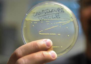 El miedo a la listeria colapsa las urgencias andaluzas