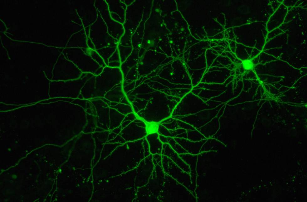 Neuronas en cultivo en el Instituto de Neurociencias español.
