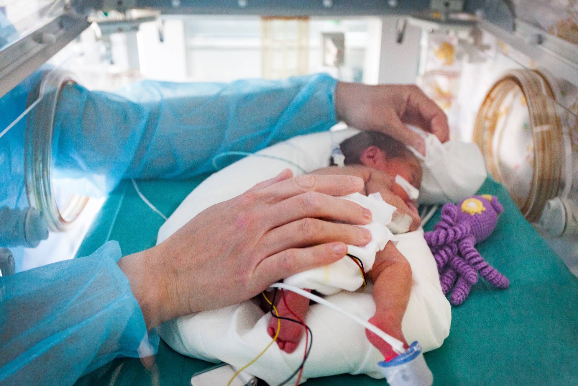 Prematuros, un reto muy controlado | Mamás y Papás | EL PAÍS