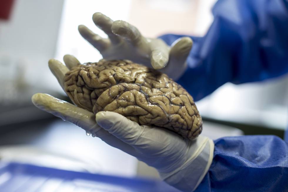 El investigador David Aguillón muestra los cerebros que tienen en el neurobanco del Grupo de Neurociencias de la Universidad de Antioquia.