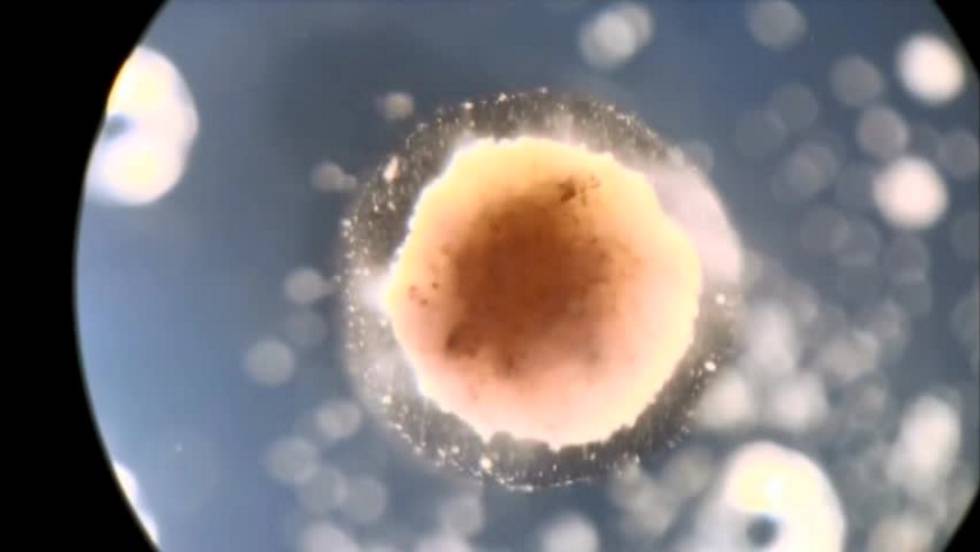 Uno de los 'biobots' de medio milímetro creados por el equipo de Michael Levin y Josh Bongard.