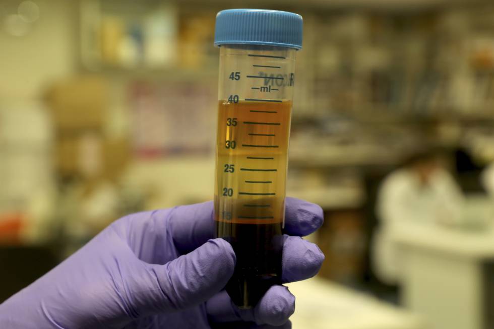 A researcher holds a blood sample in the laboratory of the biobank of Gregorio Marañón.