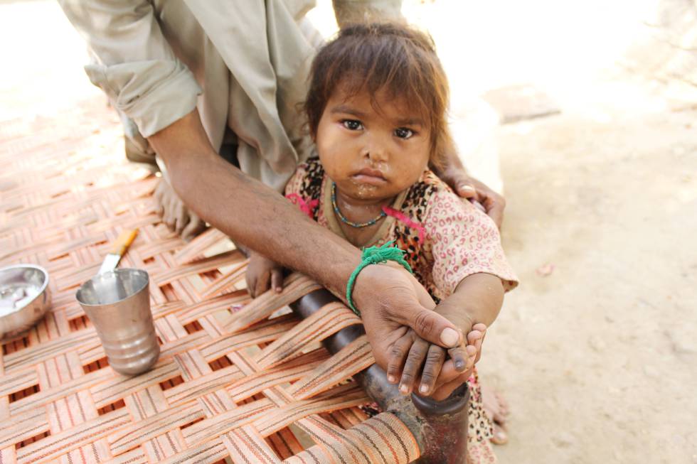 El dedo de esta niña marcado en negro indica que ha sido vacunada contra la poliomielitis.