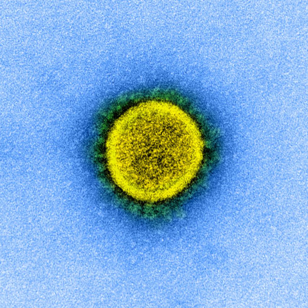Micrografía del virus SARS-CoV-2.