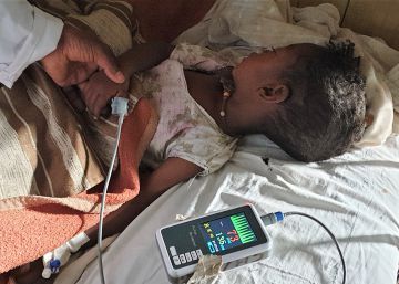 Morir por sarampión en los tiempos del coronavirus