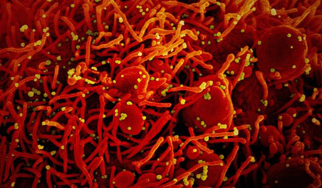 Los misterios del SARS-CoV-19, un mal bicho