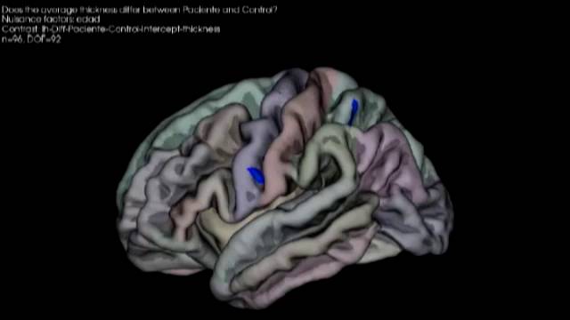¿Qué le hace la música a nuestro cerebro?