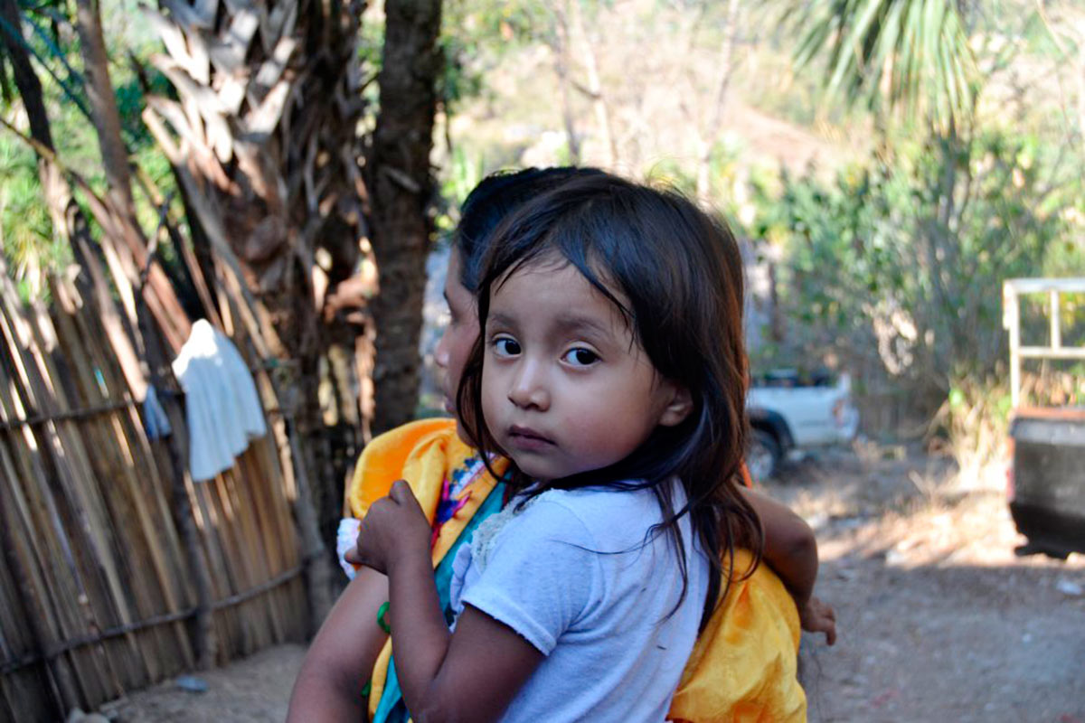 Un 67% de los niños menores de cinco años del municipio de Jocotán padecen de desnutrición crónica