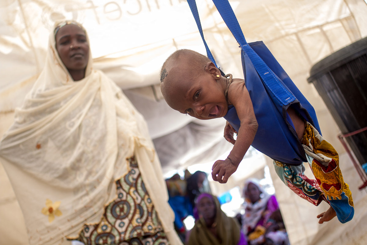 Centro de recuperación nutricional del campo de desplazados de Nguel Wanzam
