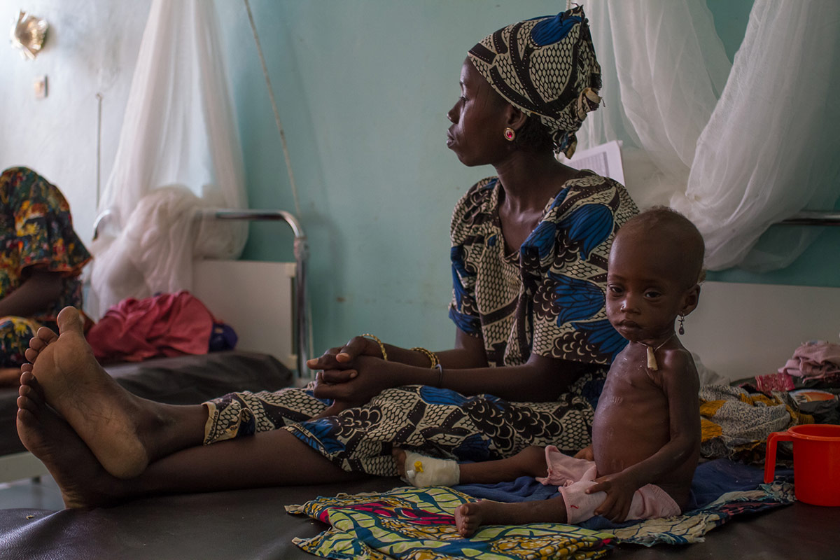 Niños menores de cinco años con malnutrición aguda severa