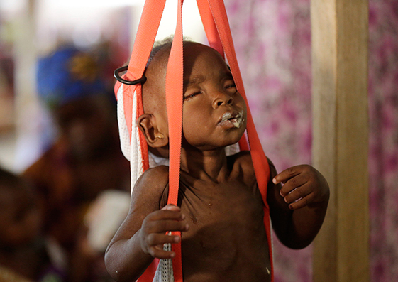 Un pequeño malnutrido es pesado en una báscula en un centro médico en Maiduguri, Nigeria, en agosto de 2016. Miles de críos han muerto de hambre y por enfermedades en esta zona asolada por Boko Haram.
