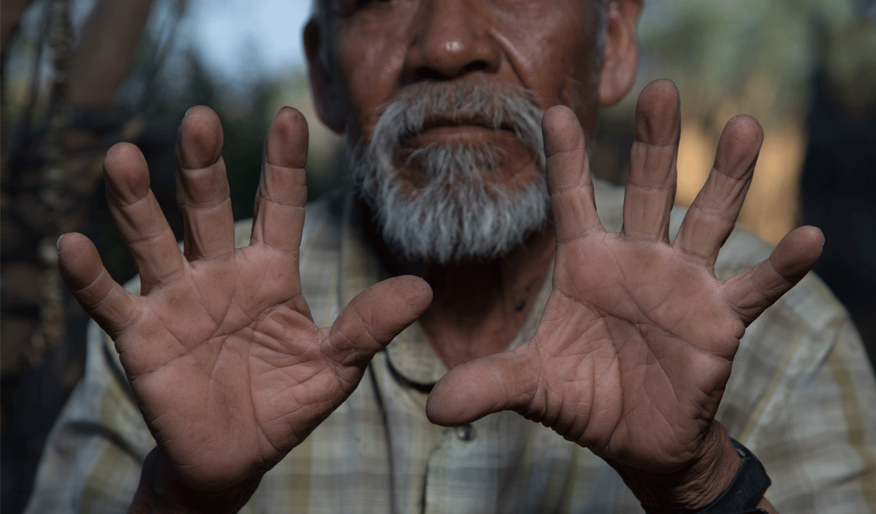 Marino muestra sus manos dedicadas por décadas al campo