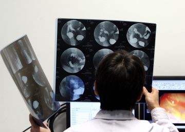 Un doctor mira radiograf&iacute;as de pacientes en el Hospital de la Amistad en Pek&iacute;n.