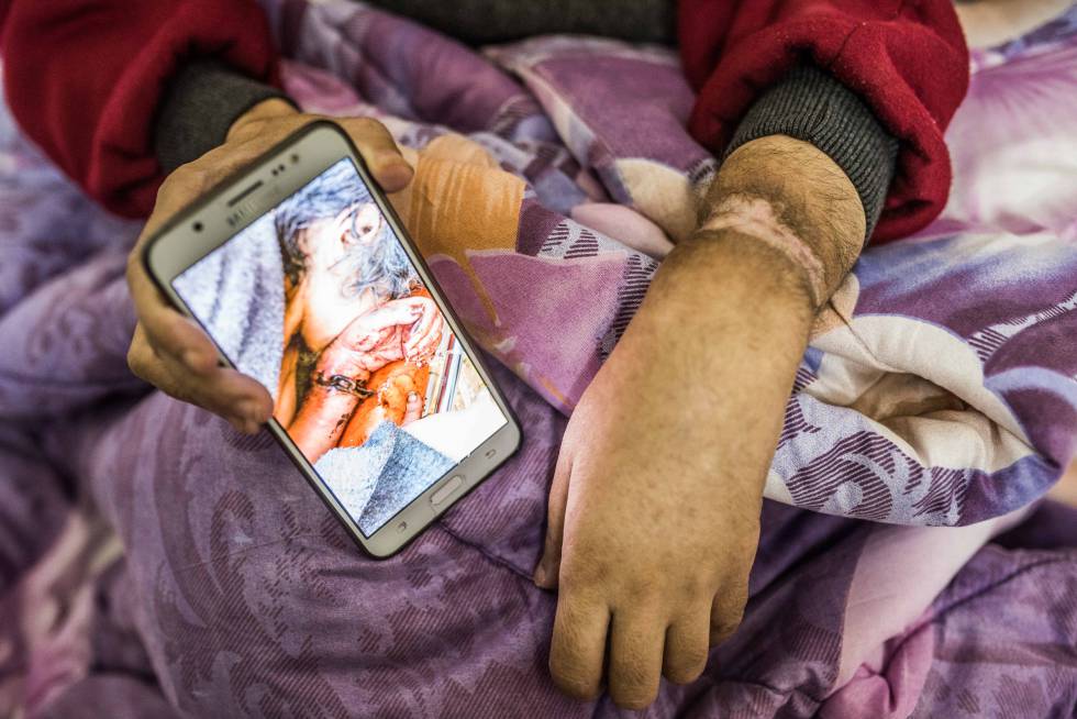 Esta antigua enfermera de 42 años y madre de dos menores, perdió la cordura cuando su marido huyó con todos sus ahorros dejándola encadenada durante dos años en la cocina de su casa en zona insurrecta de Homs