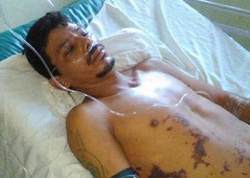 Un caso de brutalidad policial conmociona Nicaragua