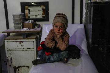 Un niño de 6 años en un hospital de la ciudad de Duma, en la zona de Guta Oriental, en marzo.