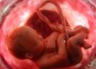 Holanda paraliza un ensayo médico con Viagra en embarazadas tras la muerte de 11 bebés