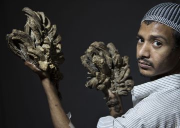 El ‘hombre árbol’ de Bangladés pierde la esperanza de curarse tras una veintena de operaciones