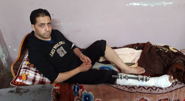Refat al Buhaisi, torturado por fuerzas de seguridad de Hamás, en su casa de Deir el Balah (Gaza).