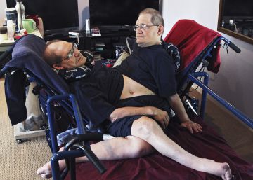 Mueren los dos hermanos siameses más longevos del mundo