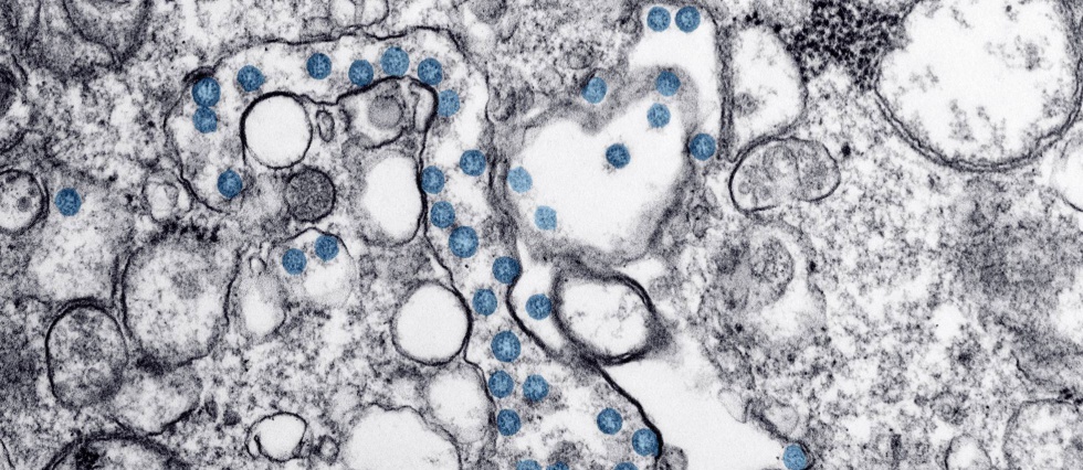 Imagen del coronavirus al microscopio.