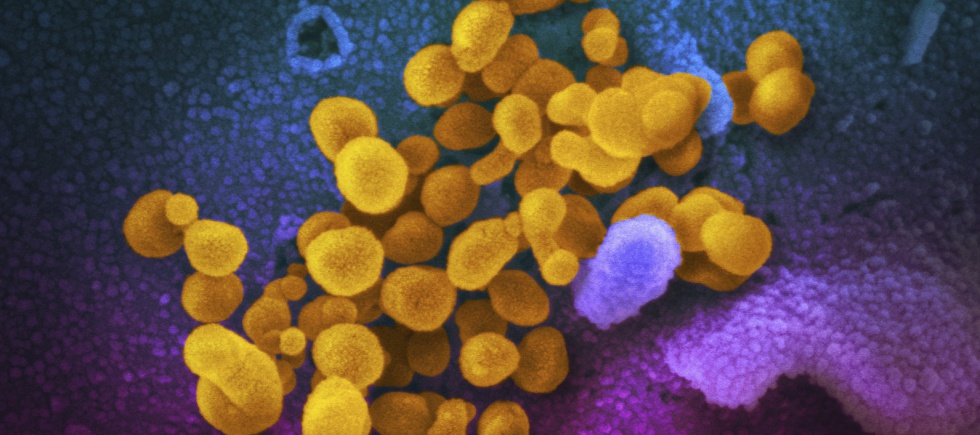 Una imagen de microscopio del SARS-CoV-2 (en amarillo).