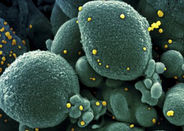 Los números del coronavirus: ¿cuál es la letalidad de la enfermedad ahora?