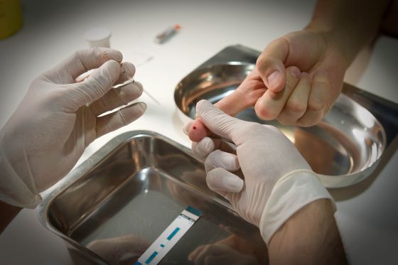 En España las pruebas del VIH solo se hacen en el ámbito sanitario. / TEJEDERAS
