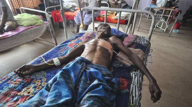 Un enfermo de tuberculosis en un hospital en Agartala.