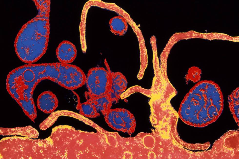 Microfotografía electrónica coloreada del virus del sarampión infectando una célula.