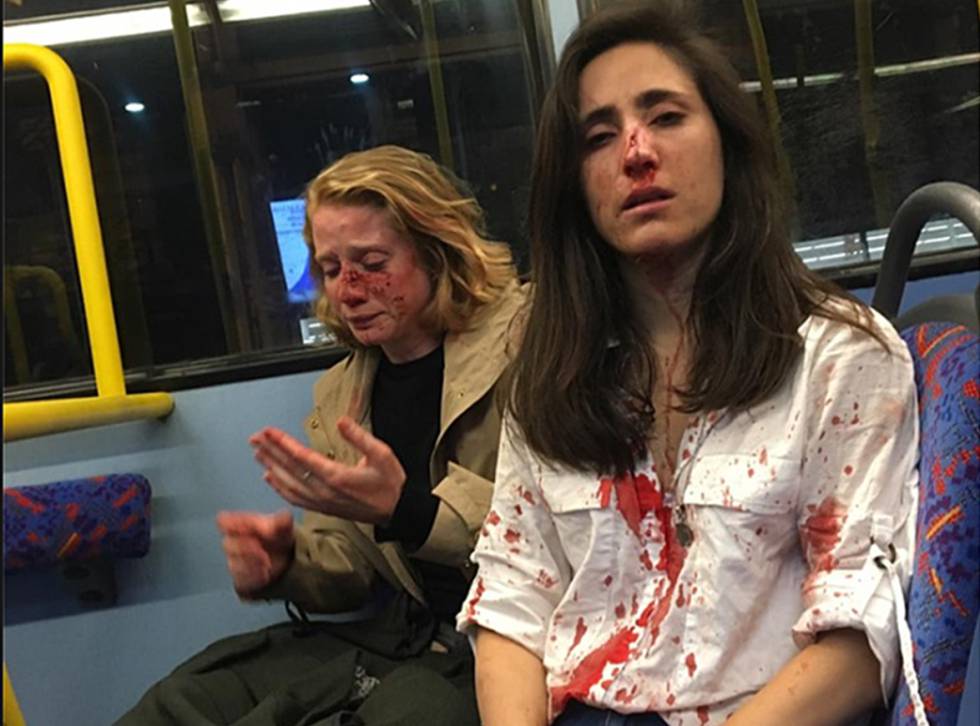 Melania Geymonat y su novia, tras la agresión que sufrieron en un autobús de Londres el 30 de mayo.